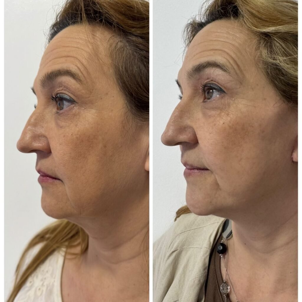 Casal - A-D_web_Casal_4