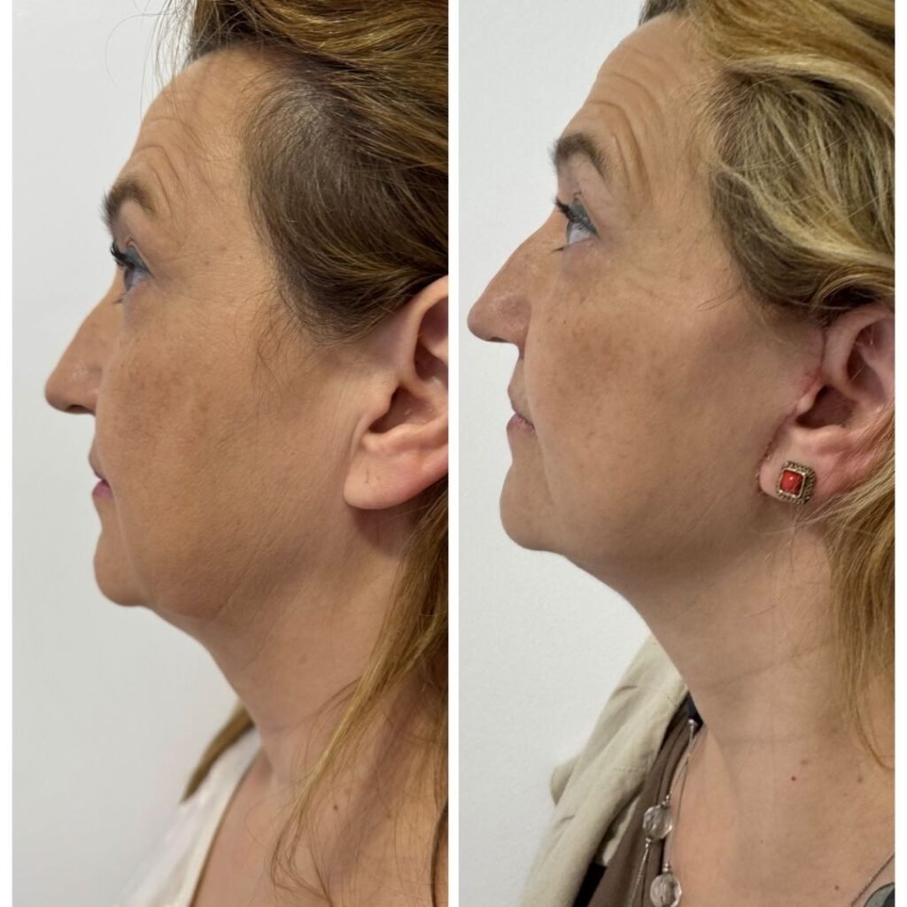 Casal - A-D_web_Casal_5