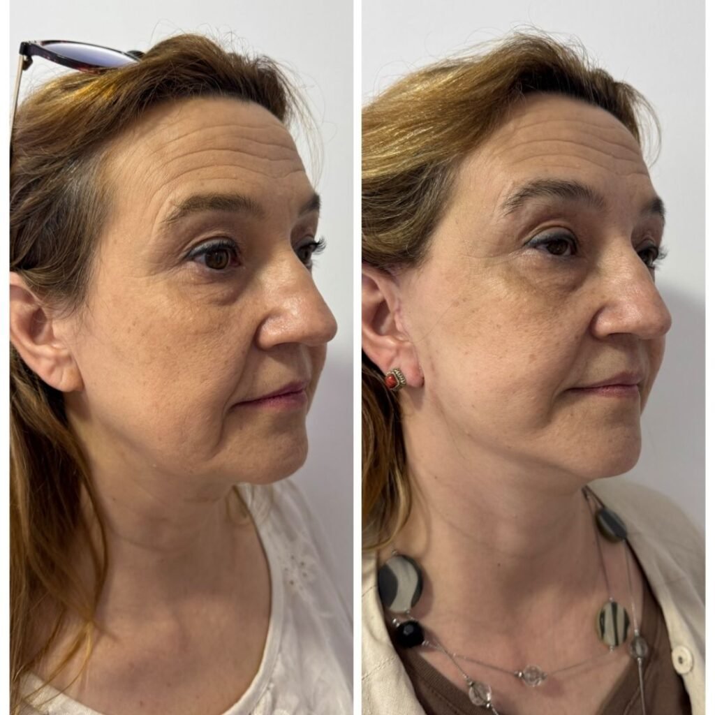 Casal - A-D_web_Casal_6