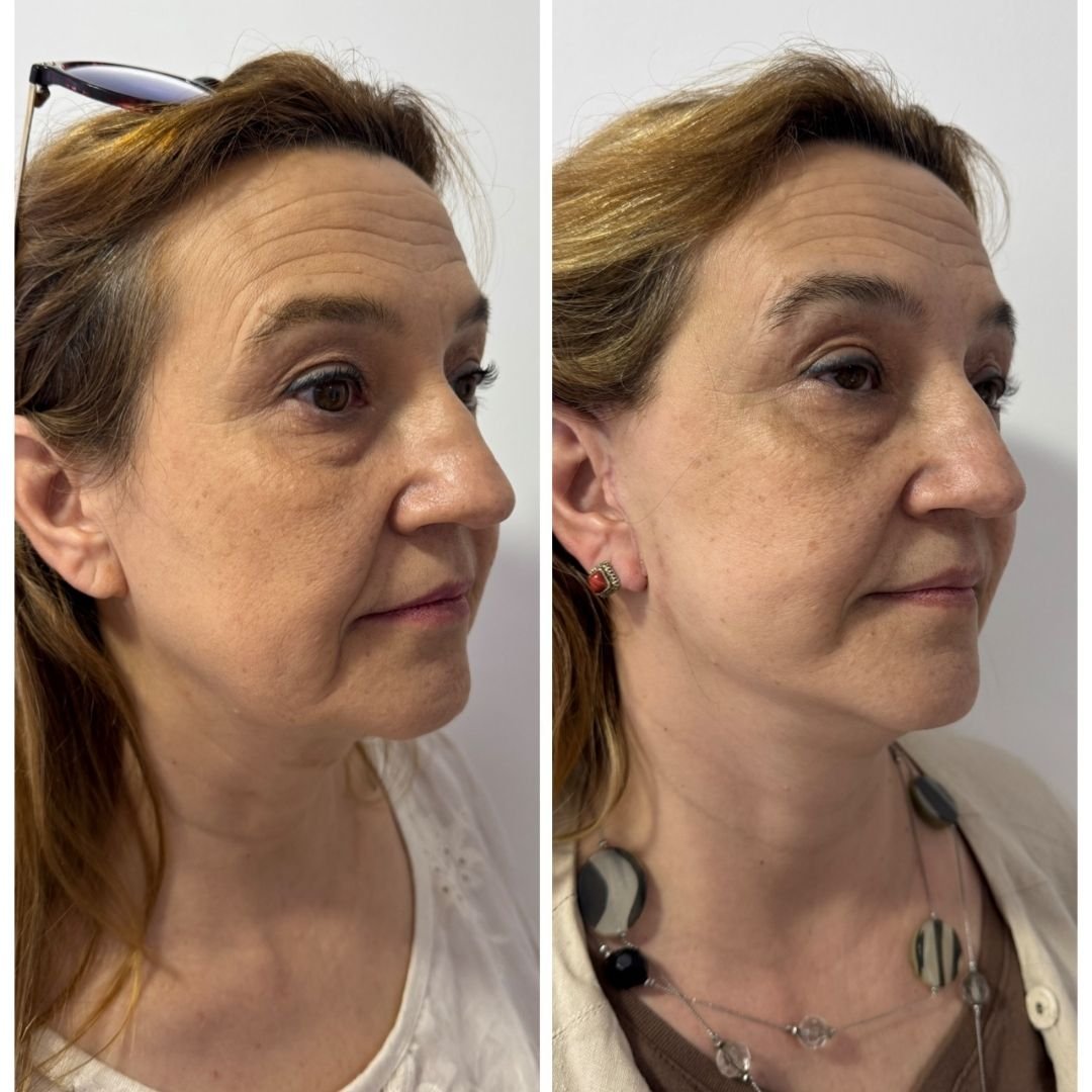 Casal - A-D_web_Casal_6