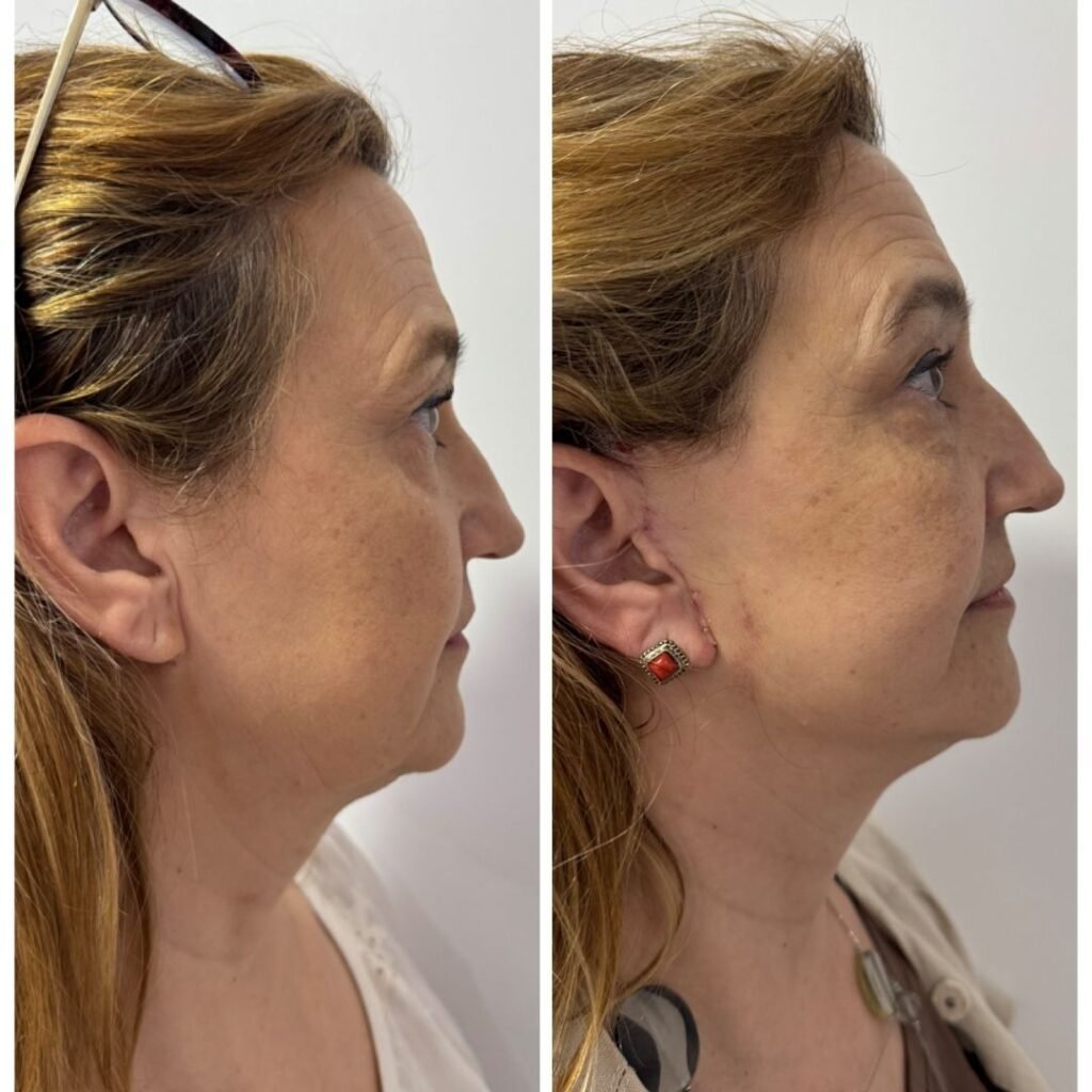 Casal - A-D_web_Casal_7