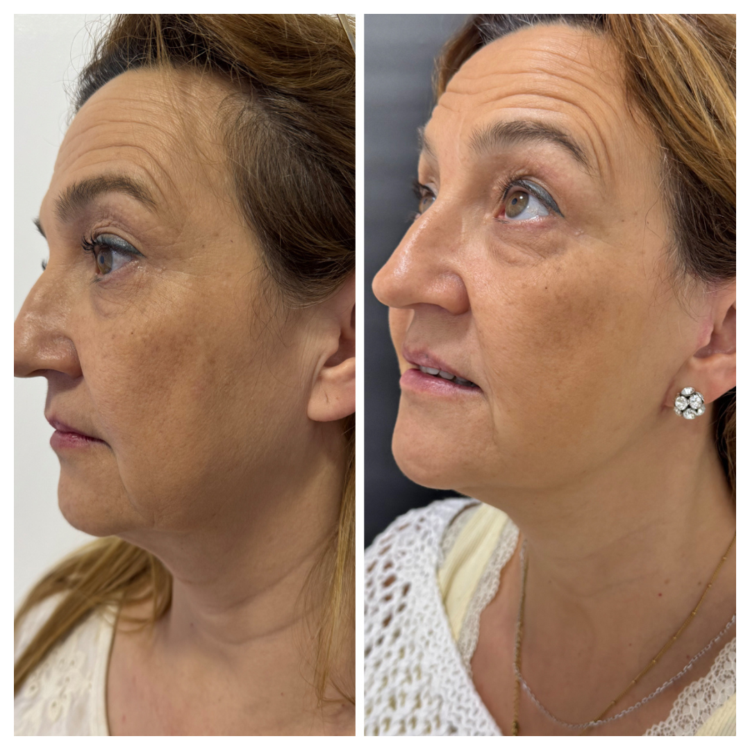2_1